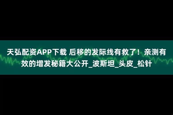 天弘配资APP下载 后移的发际线有救了！亲测有效的增发秘籍大公开_波斯坦_头皮_松针